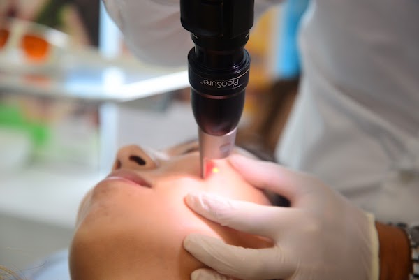 Anti-Ageing Clear Skin PicoSure Laser Singapore 
